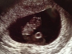 first ultrasound: 9 weeks