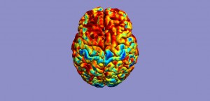 Why Women Are at Increased Risk for Concussions